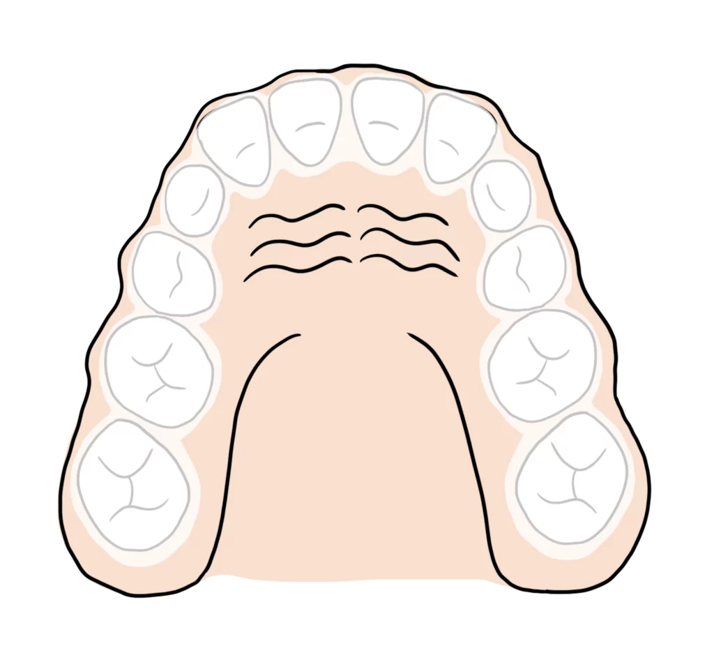 Labo FLC produit des aligneurs pour les orthodontistes