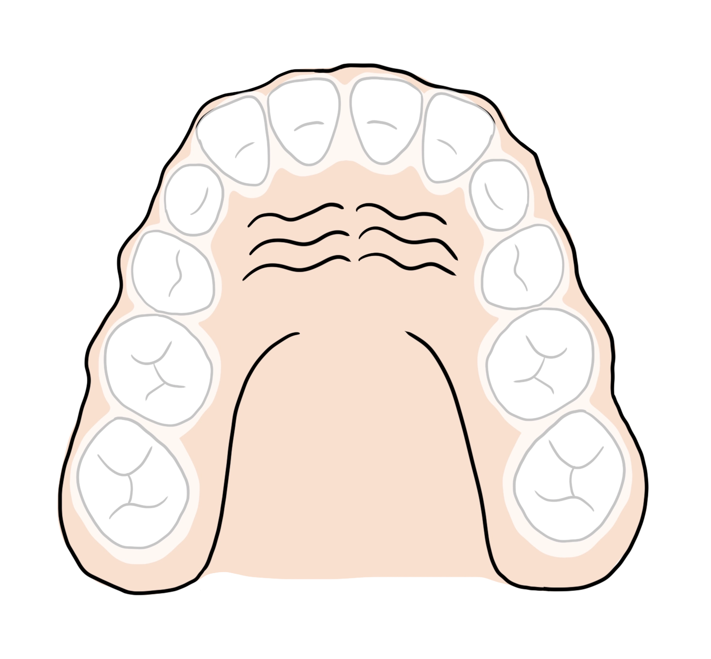 Labo FLC produit des aligneurs pour les orthodontistes