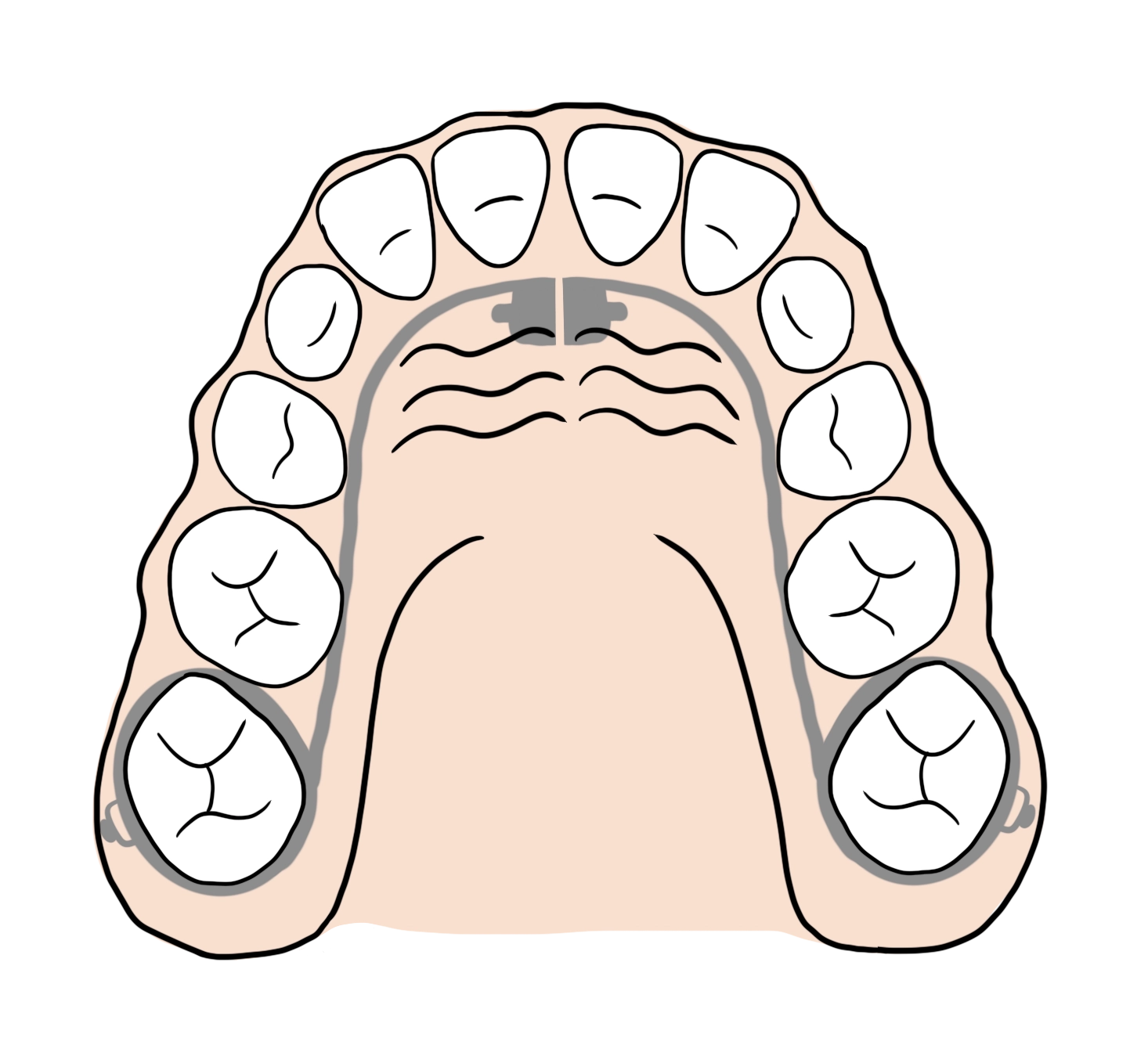 Production d'arc pour les orthodontistes