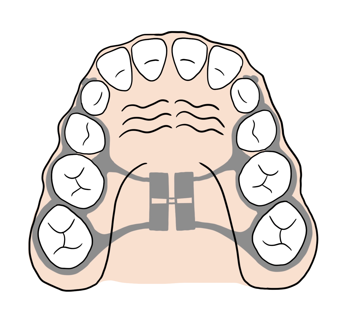 Labo FLC produit des disjoncteurs pour les orthodontistes